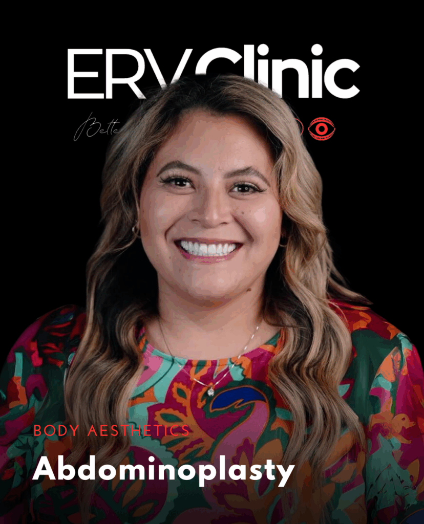 Abdominoplasty BODY AESTHETICS