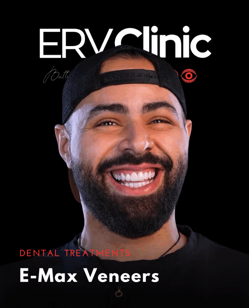 E-Max Veneers DENTAL TREATMENTS (2)