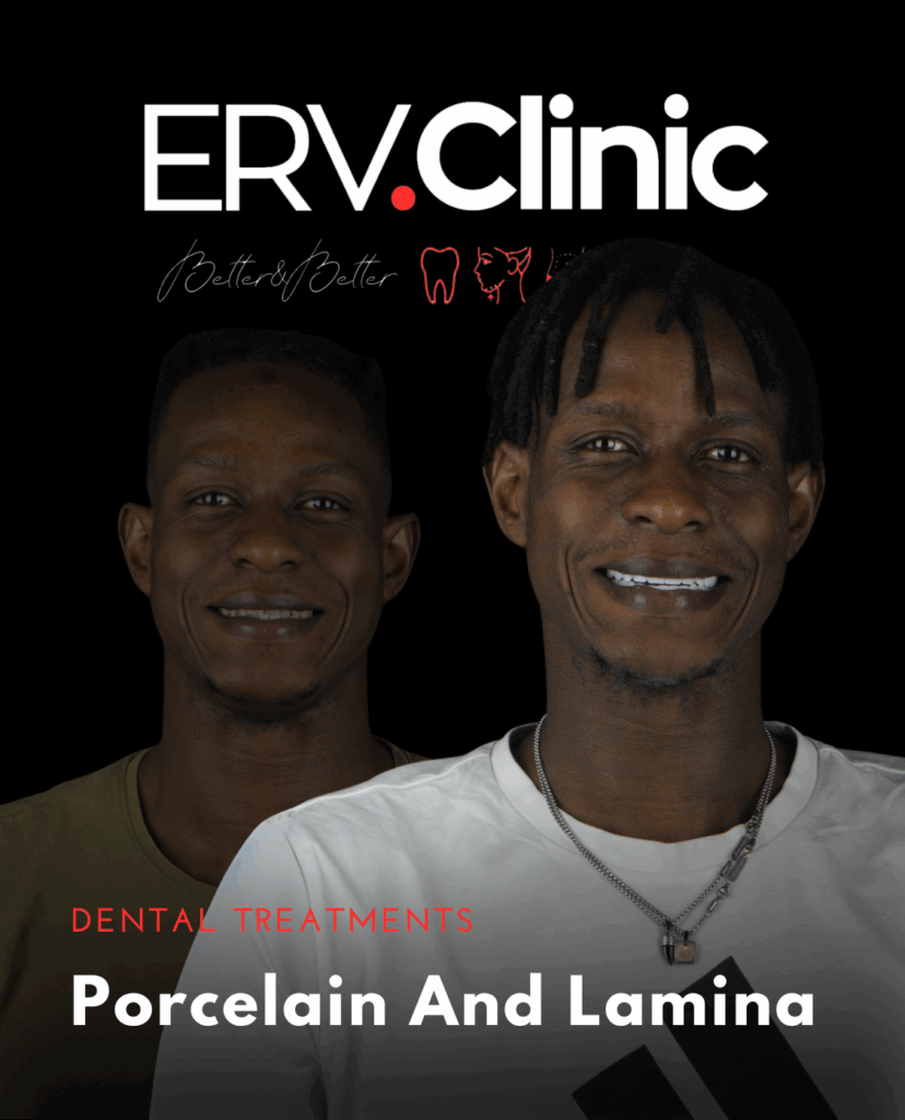 Porcelain And Lamina DENTAL TREATMENTS (2)
