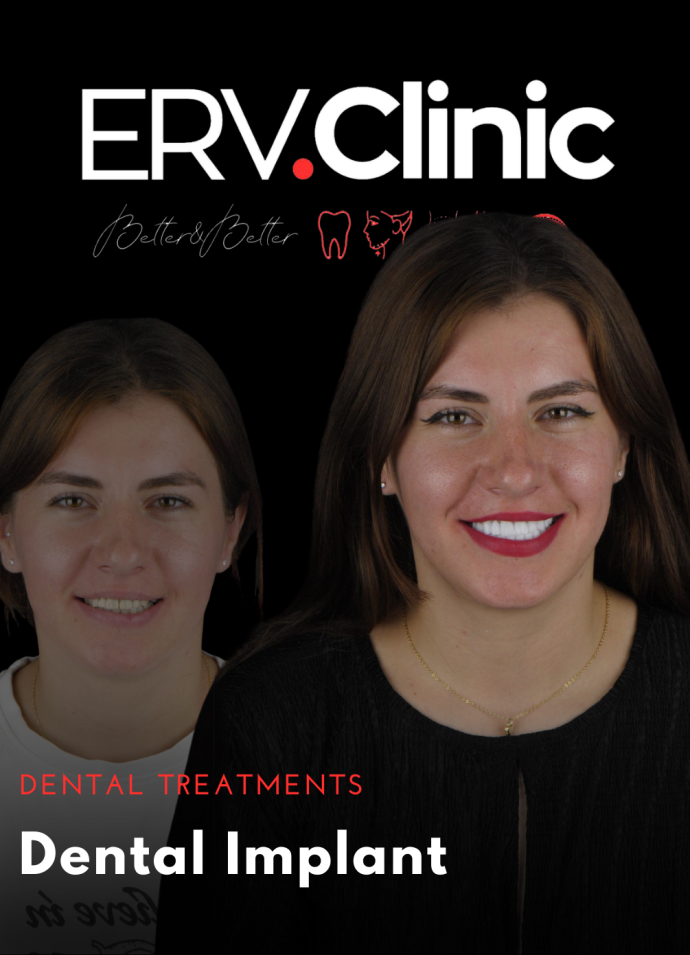 Dental Implant DENTAL TREATMENTS (2)